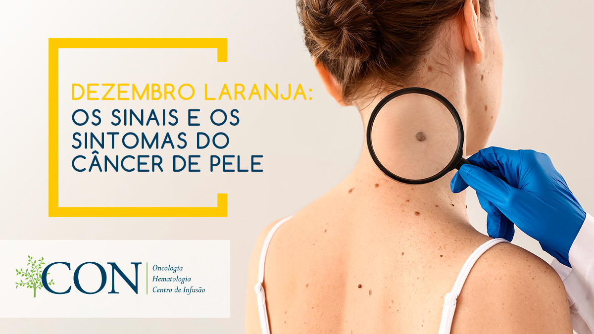 os-sinais-e-os-sintomas-do-cancer-de-pele-2.jpg