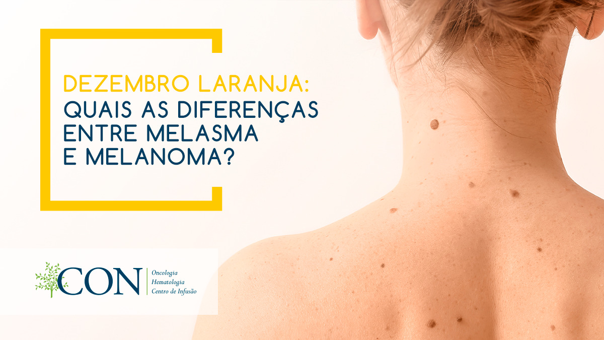 quais-as-diferencas-entre-melasma-e-melanoma.jpg